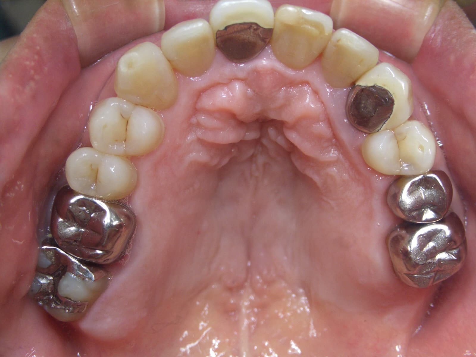 0000003255_%e9%b9%bf%e9%87%8e-%e6%86%b2%e6%b2%bb_camera_20140805111456