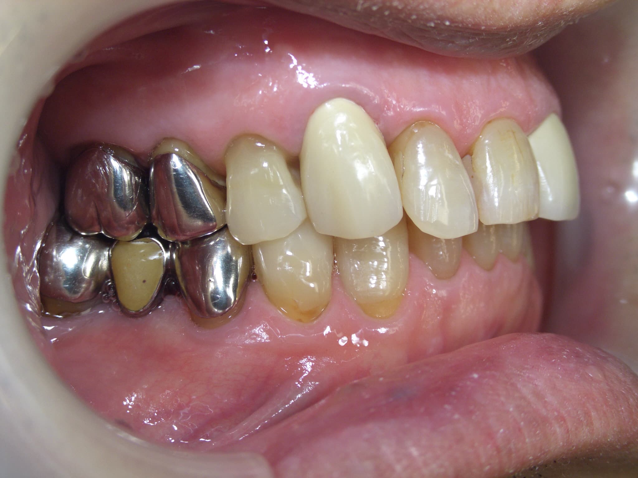 0000003255_%e9%b9%bf%e9%87%8e-%e6%86%b2%e6%b2%bb_camera_20141117034013