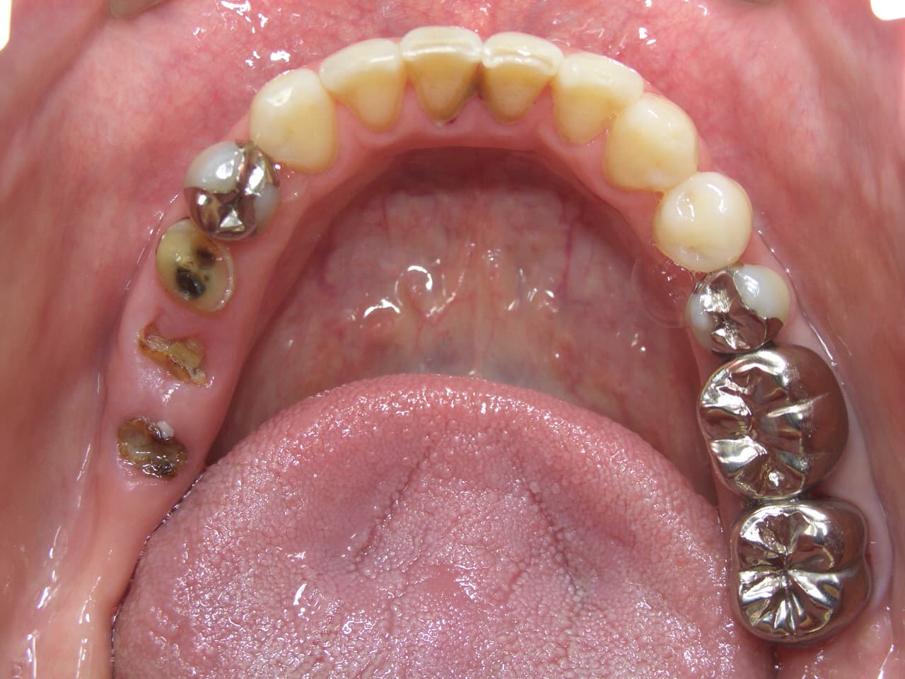 0000001770_%e4%bd%90%e8%97%a4-%e7%9c%9e%e6%9c%a8%e5%ad%90_camera_20100924153108