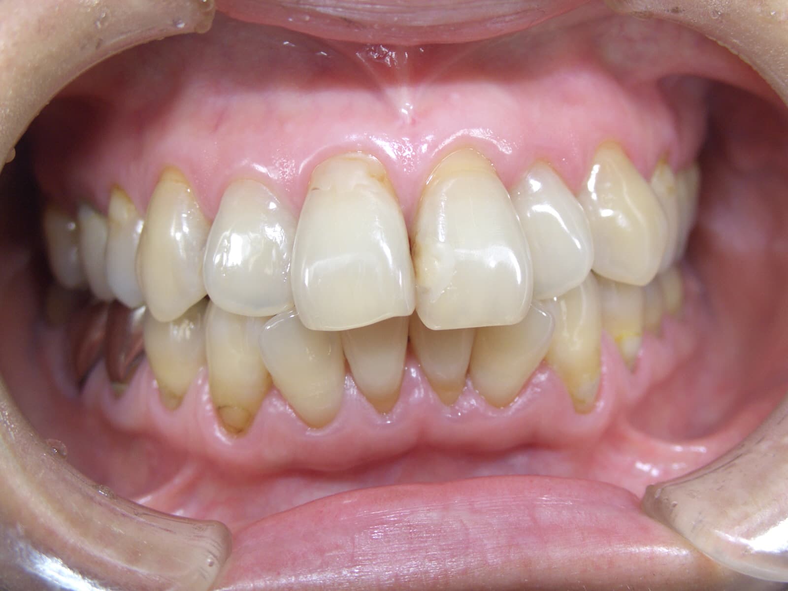 0000003276_%e6%9d%be%e7%94%b0-%e7%be%8e%e7%b4%80_camera_20140825011346