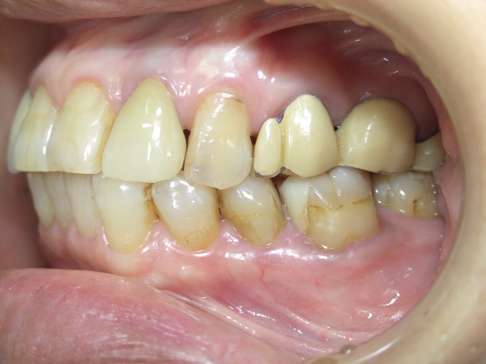 0000003309_%e5%b0%8f%e7%ac%a0%e5%8e%9f-%e7%ab%a0%e5%ad%90_camera_20141007152748