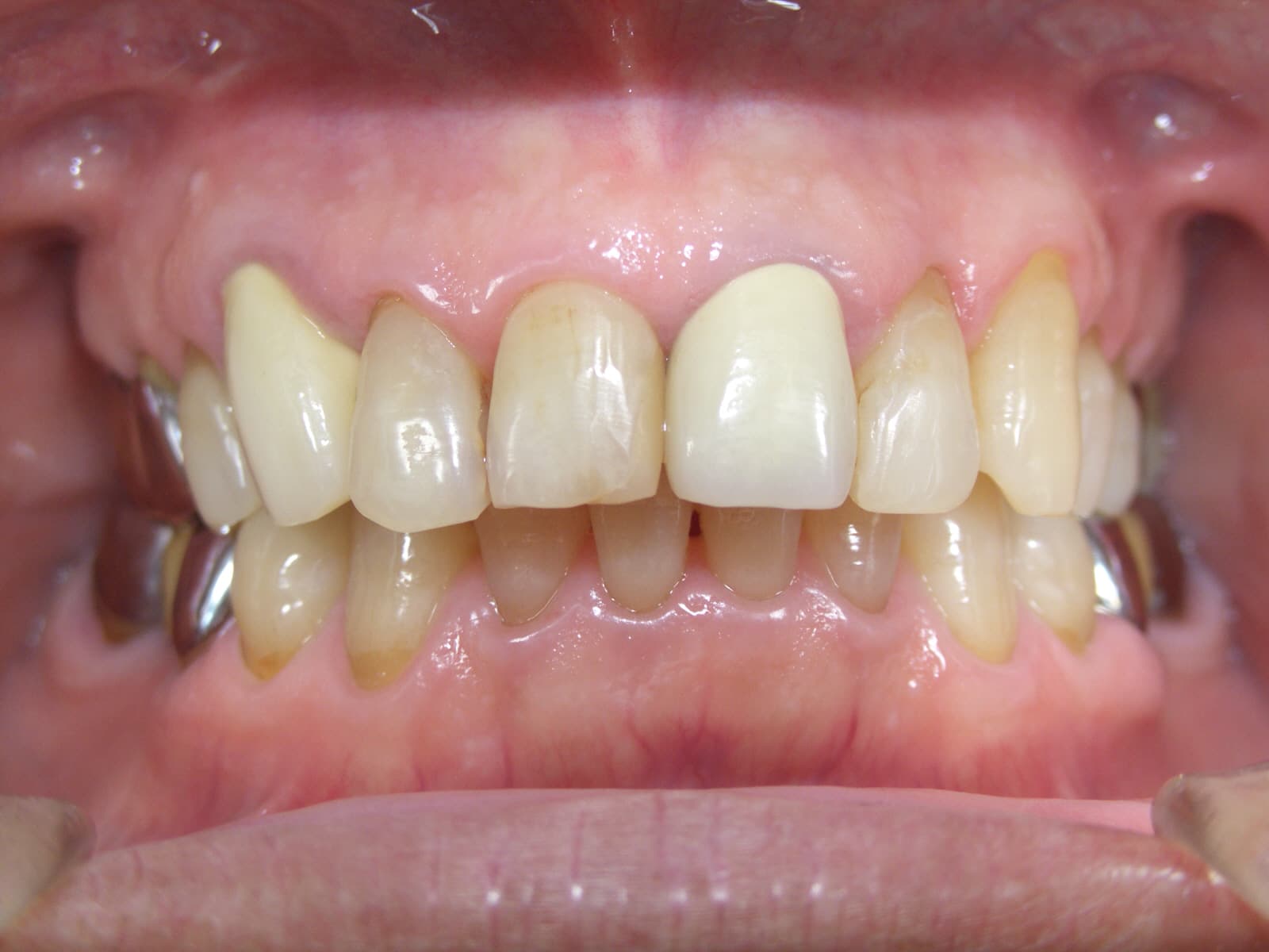 0000003255_%e9%b9%bf%e9%87%8e-%e6%86%b2%e6%b2%bb_camera_20140805111224