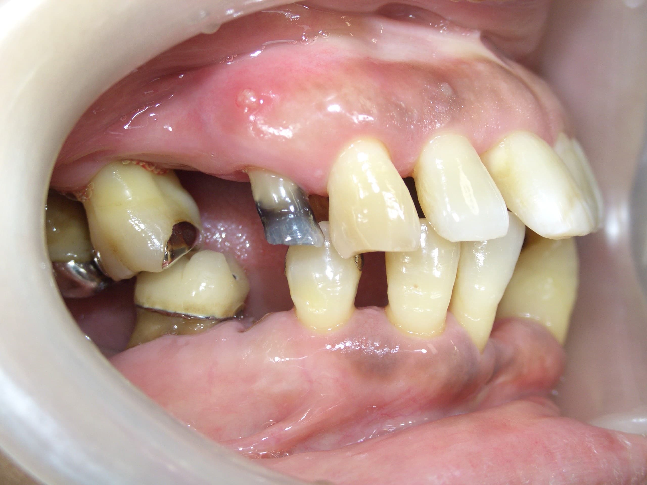 %e5%9c%9f%e7%94%b0-%e3%81%a4%e3%81%9f%e3%81%88_c04_20141229_113348010