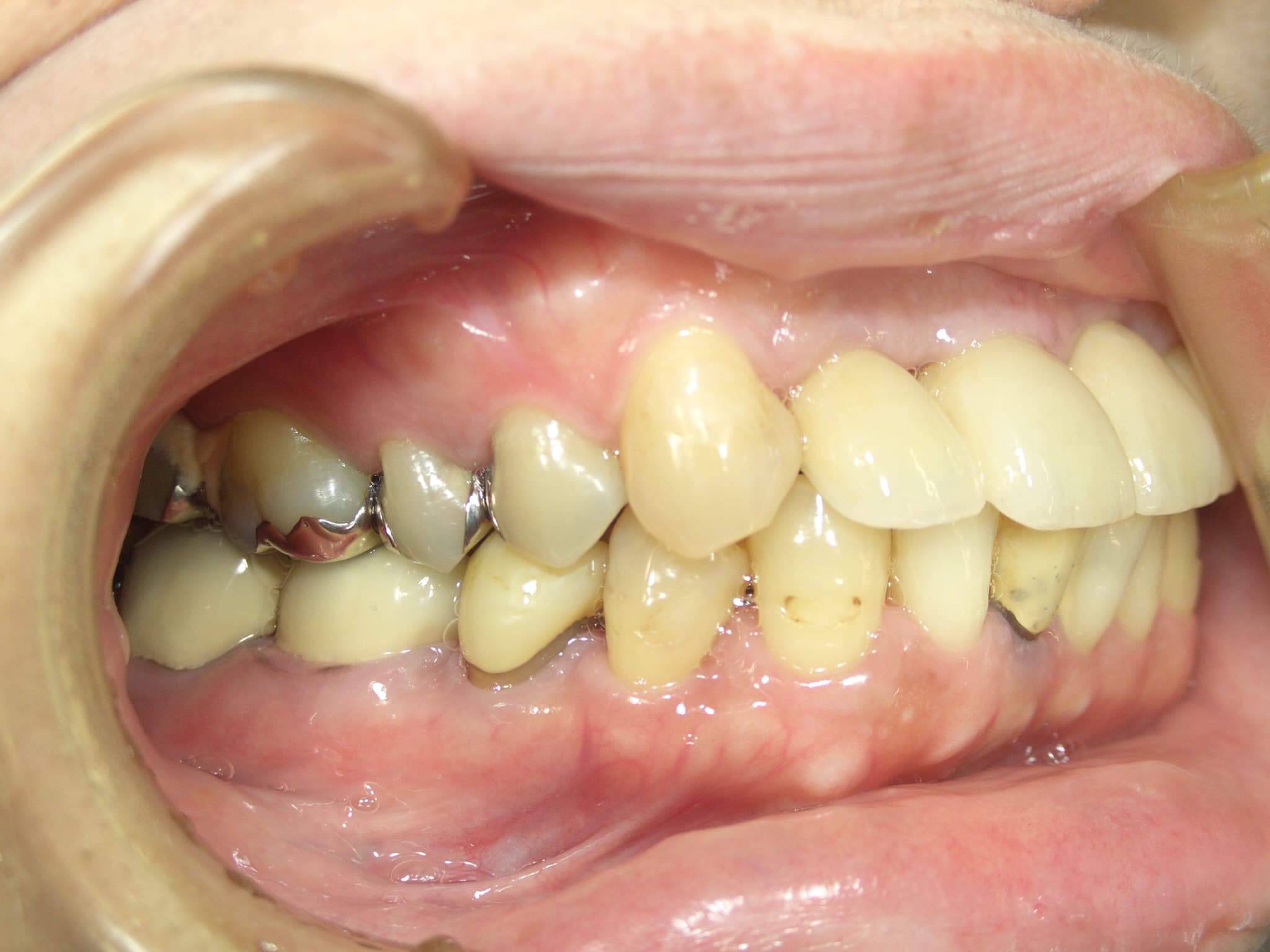 0000003433_%e5%85%90%e7%8e%89-%e5%b9%b8%e7%be%8e_camera_20150810112030