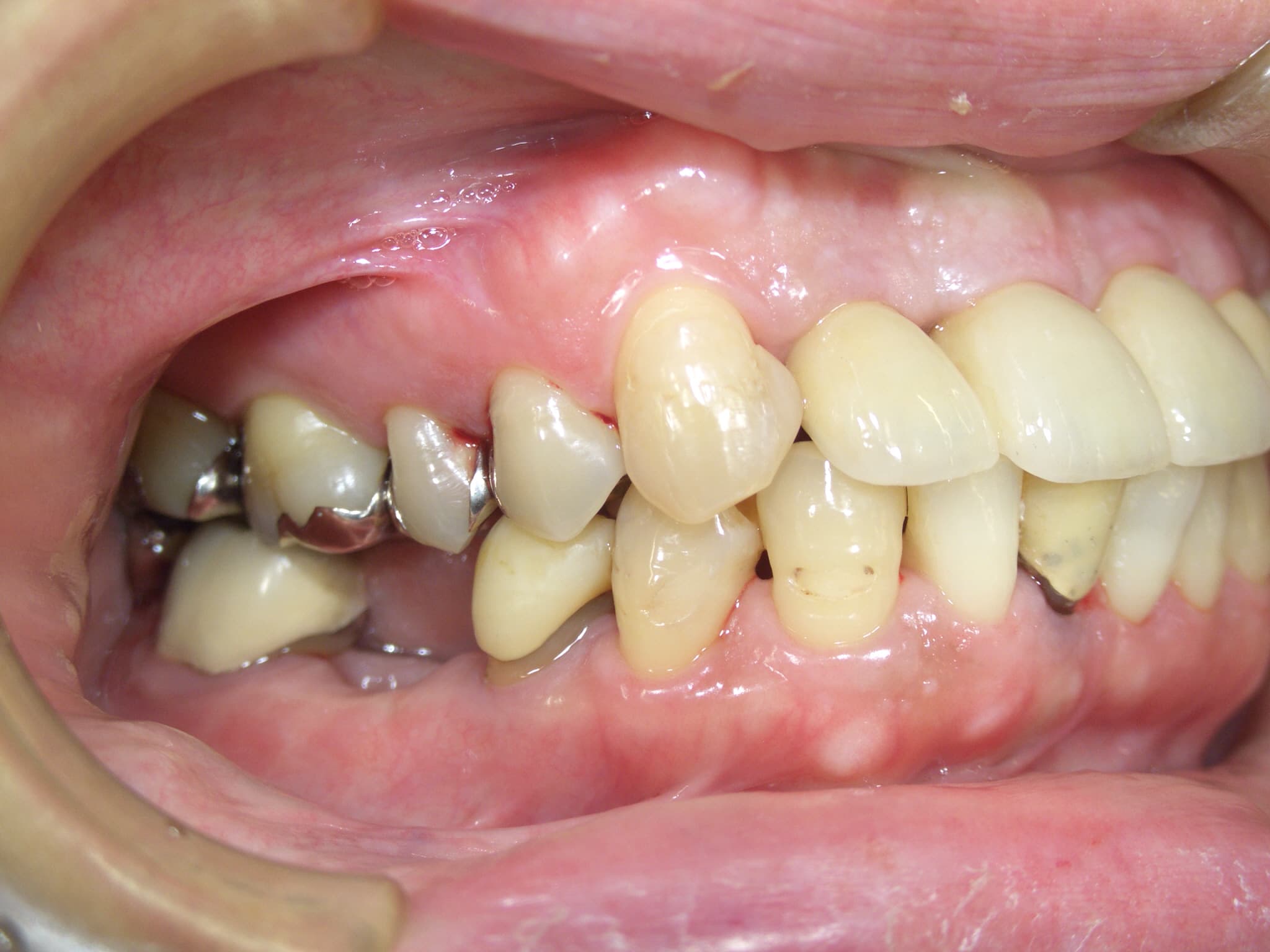 0000003433_%e5%85%90%e7%8e%89-%e5%b9%b8%e7%be%8e_camera_20151228114325