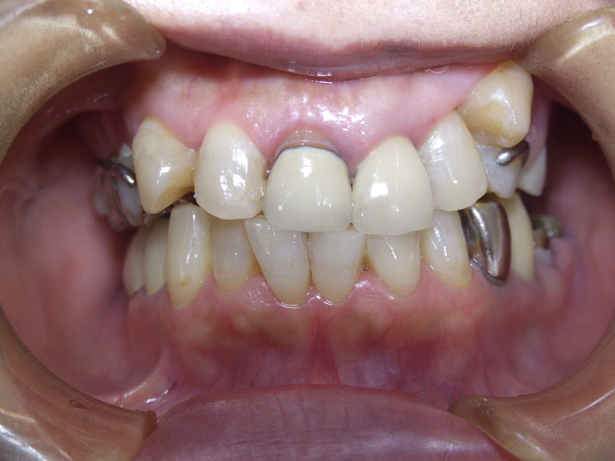 0000003401_%e7%b5%90%e5%9f%8e-%e5%a4%9a%e7%be%8e%e5%ad%90_camera_20150804111551