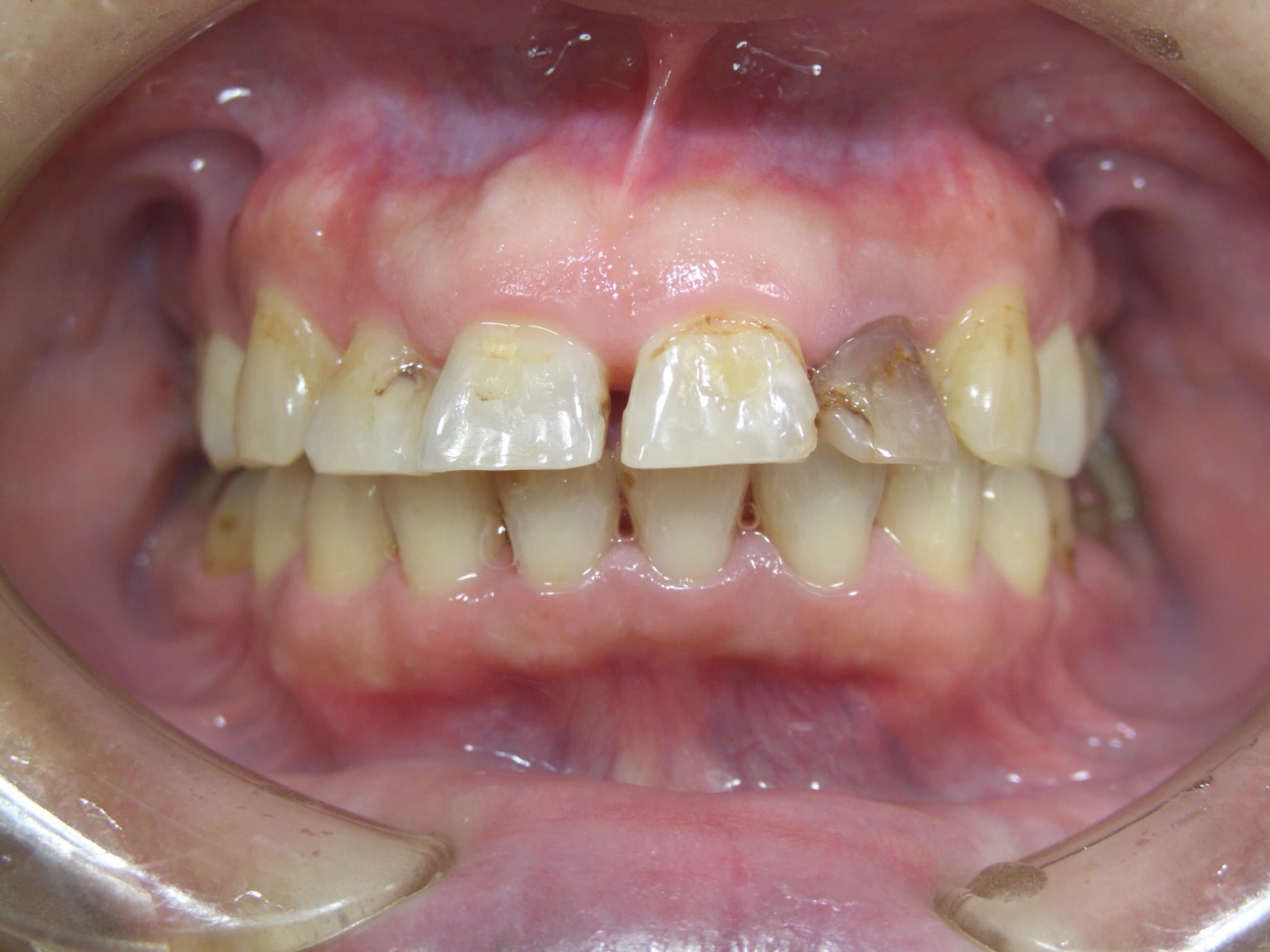 0000003419_%e5%ae%89%e9%83%a8-%e4%bb%81_camera_20151016131309