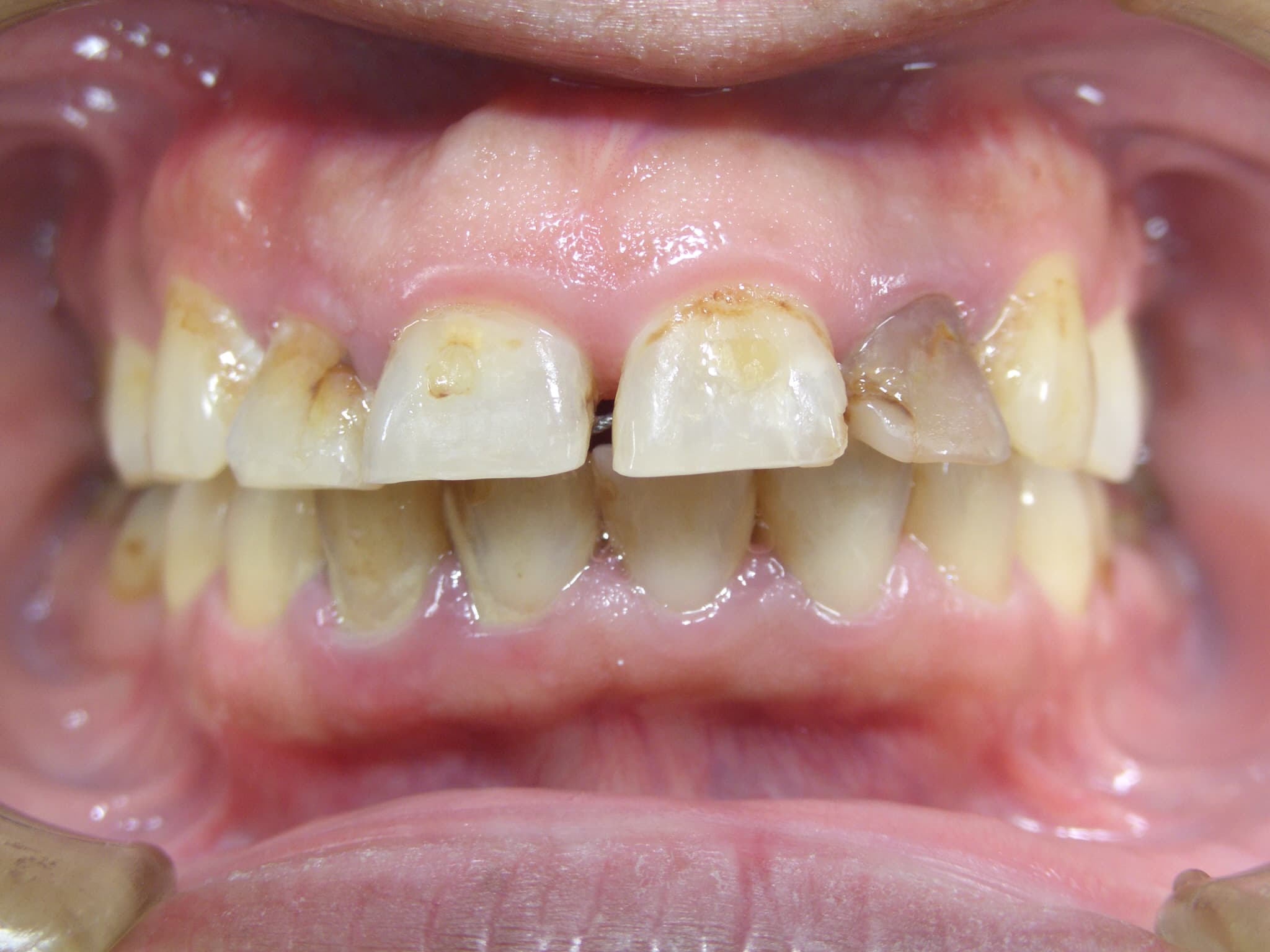 0000003419_%e5%ae%89%e9%83%a8-%e4%bb%81_camera_20150611155428